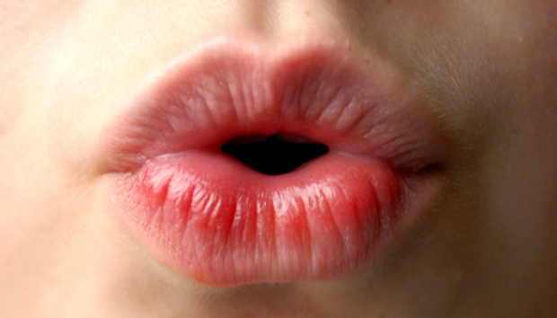 Bibir Hitam Inilah Solusinya Tuneeca Blog